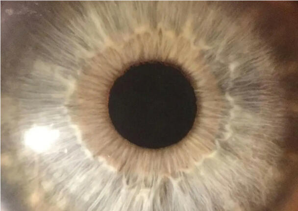 Image from SUNY News & Stories